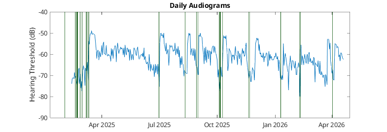 Daily audiogram hearing threshold plot from April 2025 to April 2026