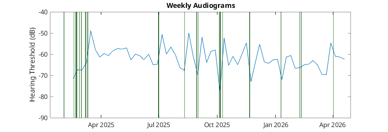 Weekly averaged audiogram hearing threshold plot from April 2025 to April 2026