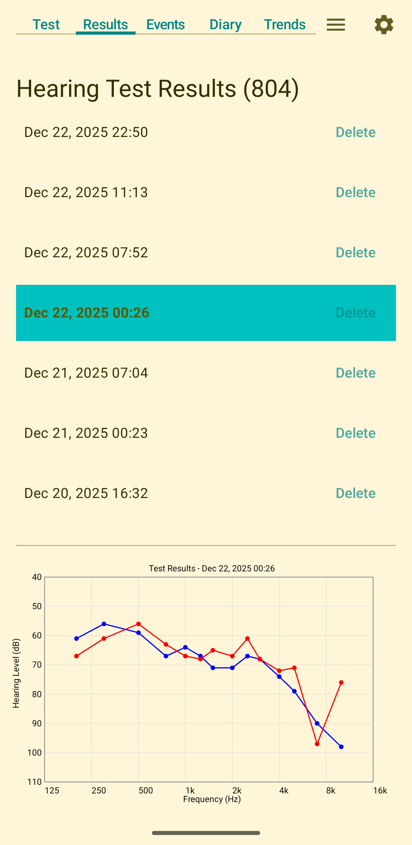 Saved audiogram results